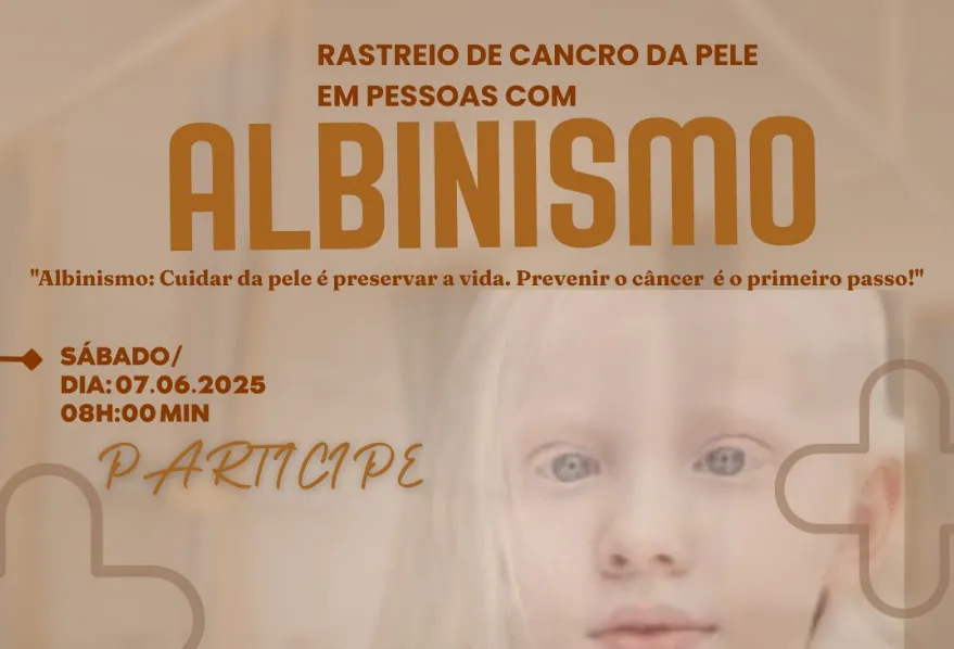 Hospital Central do Lubango participa em iniciativa nacional de rastreio ao cancro da pele em albinos